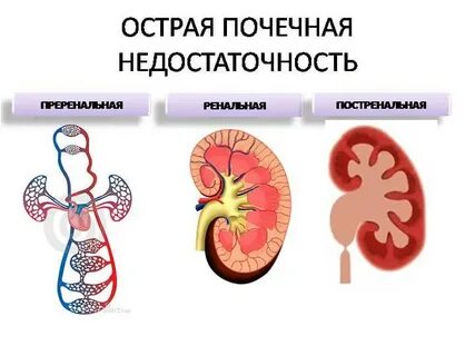 Постренальная почечная