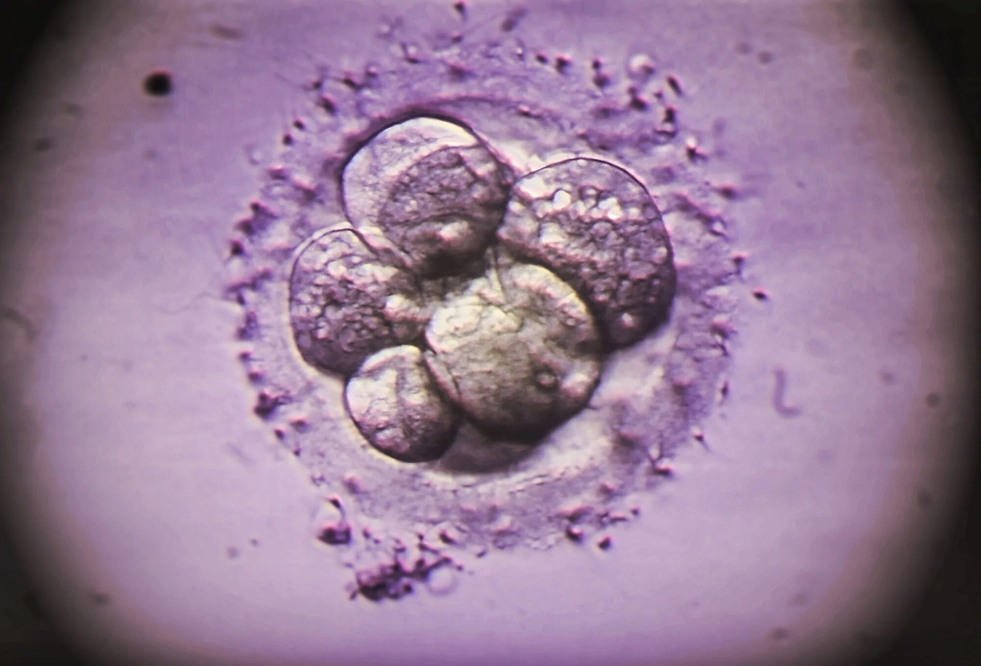После оплодотворения яйцеклетки и первых. Яйцеклетка под микроскопом. Оплодотворенная яйцеклетка под микроскопом. Эмбрионы человека микроскоп. Человеческий эмбрион под микроскопом.