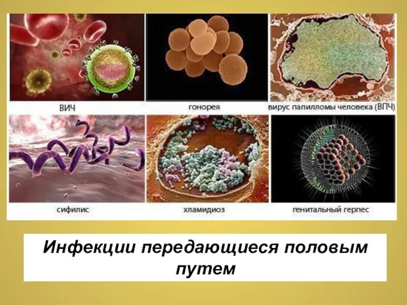 Заболевания передающиеся вирусами. Заболевания передающиеся половым путем. Инфекции передаваемые пол путем. Вирусы передающиеся половым путем.