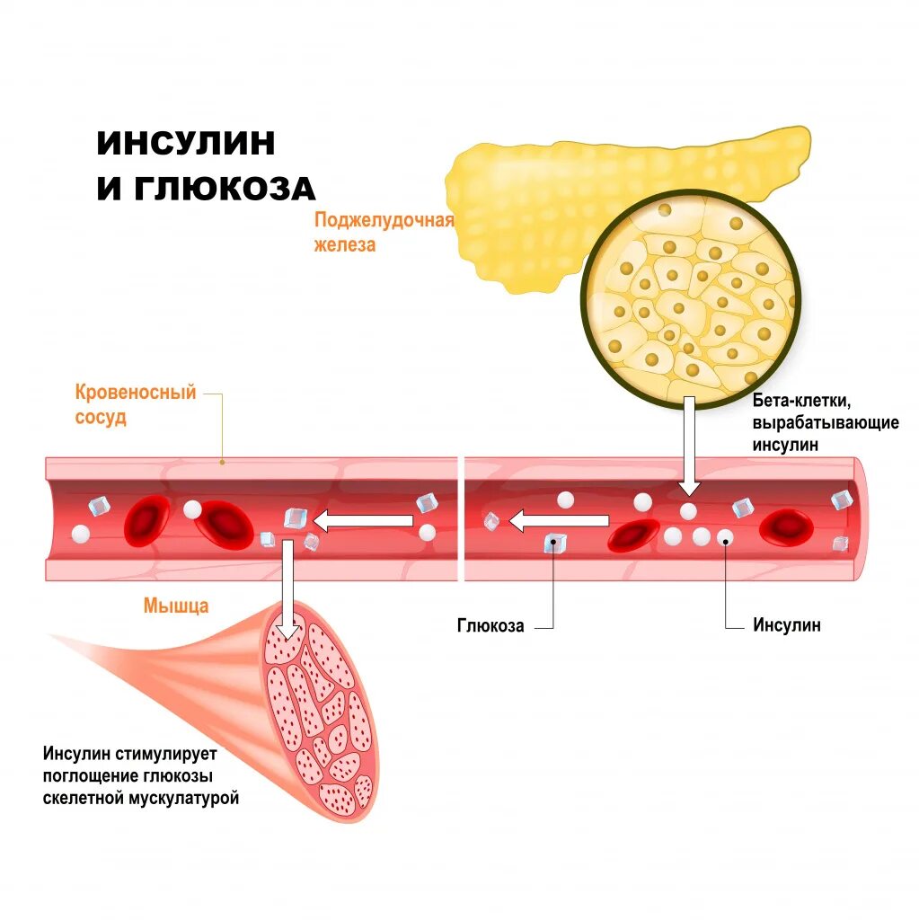 Моча при сахарном диабете у мужчин. Бета клетки поджелудочной железы. Клетки вырабатывающие инсулин. Сахарный диабет поджелудочная железа с бета клетками. Диагностика сахарного диабета 1 типа.