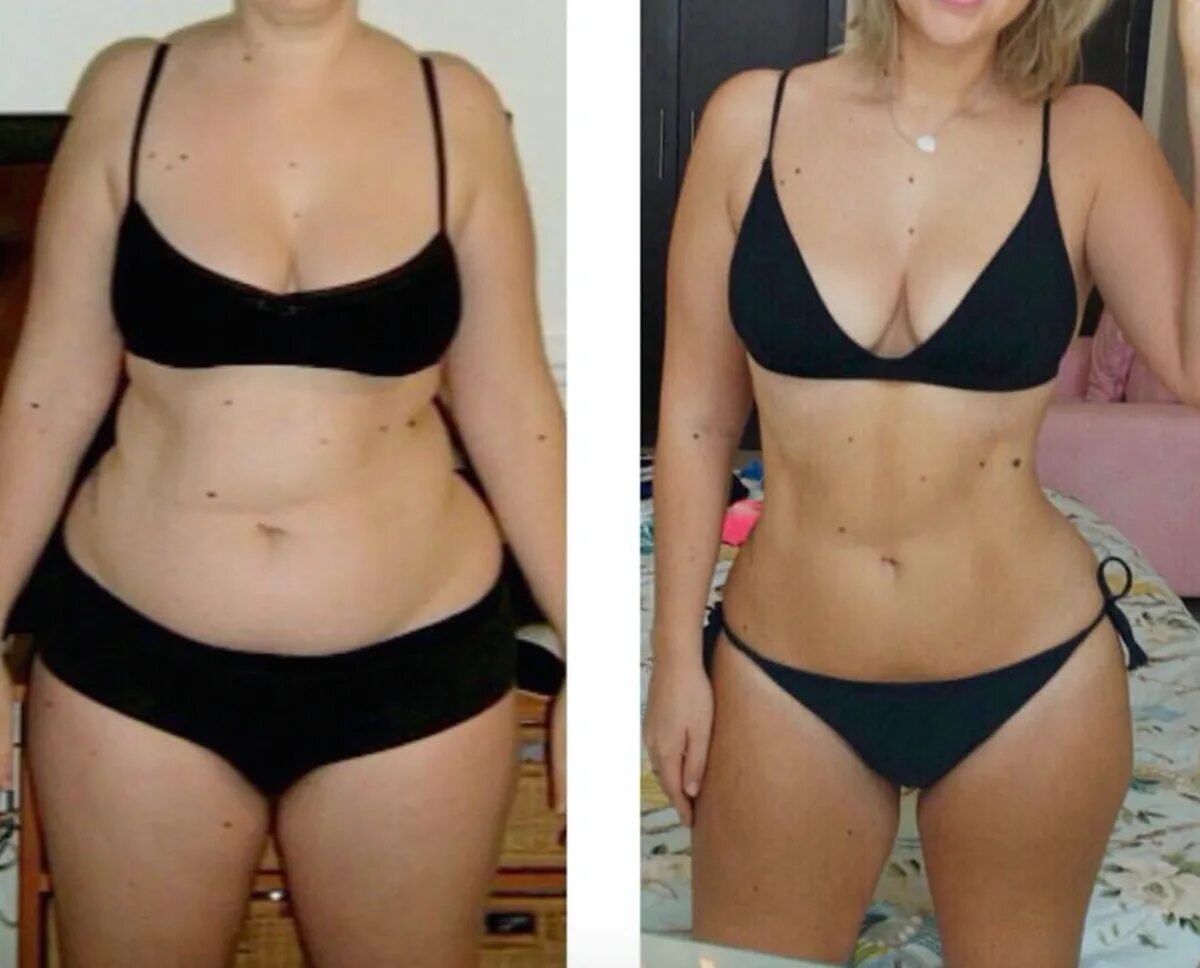Похудение до и после. Живот до и после похудения. Результаты похудения. До и после похудения девушки.