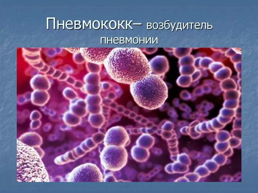 Пневмонийный стрептококк. Streptococcus pneumoniae (пневмококк). Пневмококковая инфекция возбудитель. Кокки возбудители пневмонии. Возбудитель инфекционных заболеваний бактерии