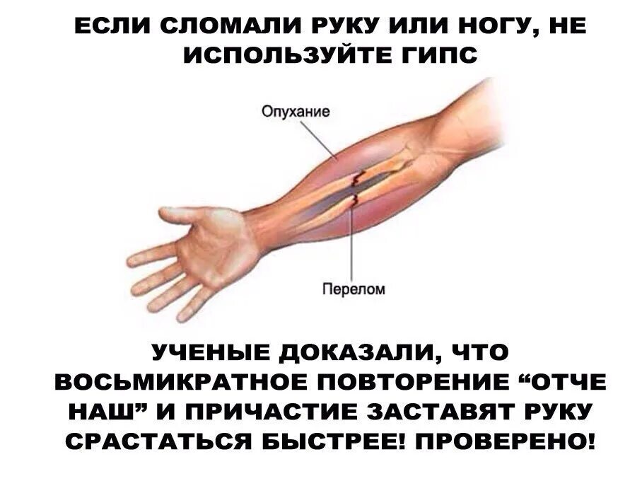 Тест на сколько сильно вы сломаны. Что делать если поломал руку. Как сломать руку или ногу.