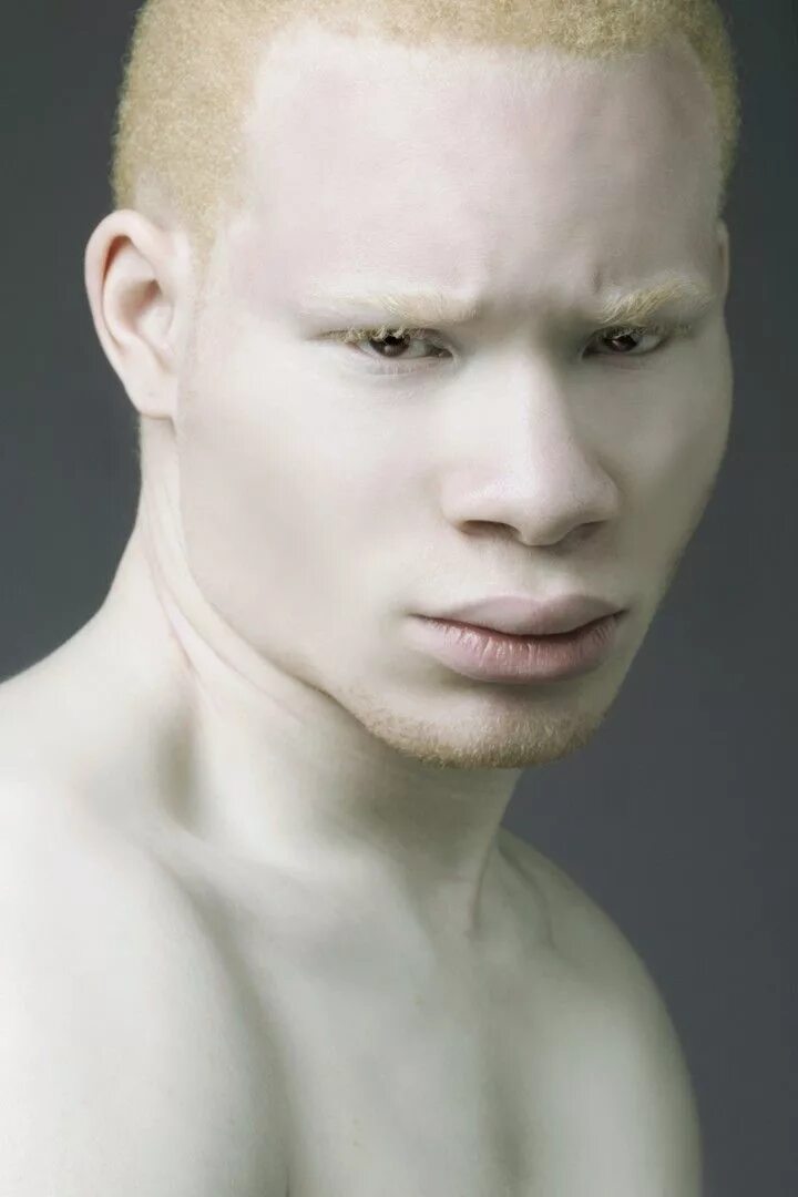 Человек с самой светлой. Джуэл Джеффри фотомодель альбинос. Сэр Маджор пейдж.