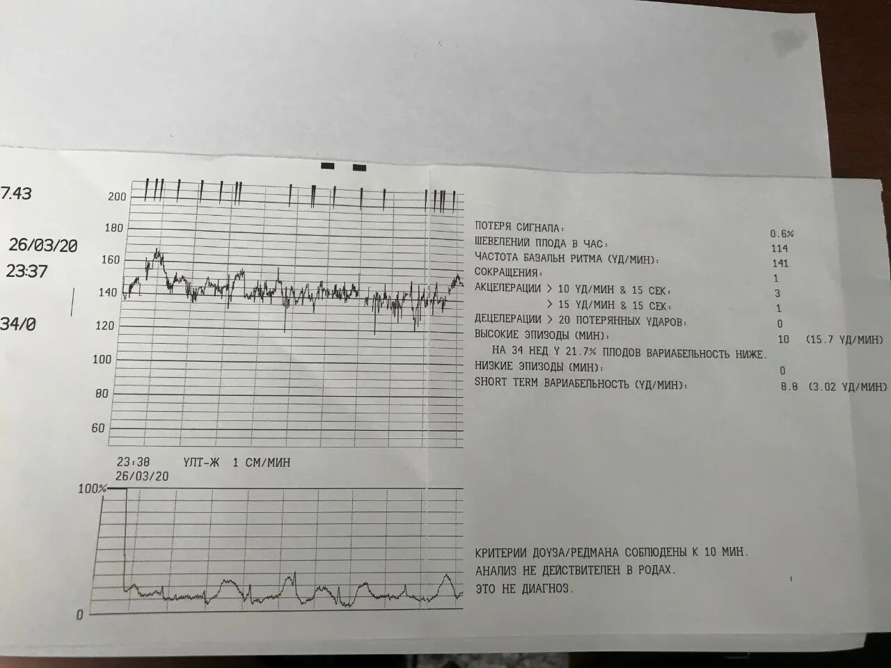 Схватки на 34. Нормальные показатели КТГ плода. КТГ при беременности норма 31-32 недели беременности. Расшифровка КТГ норма таблица. КТГ нормальные показатели на 37 неделе.