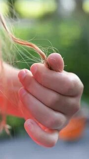 Finger hair