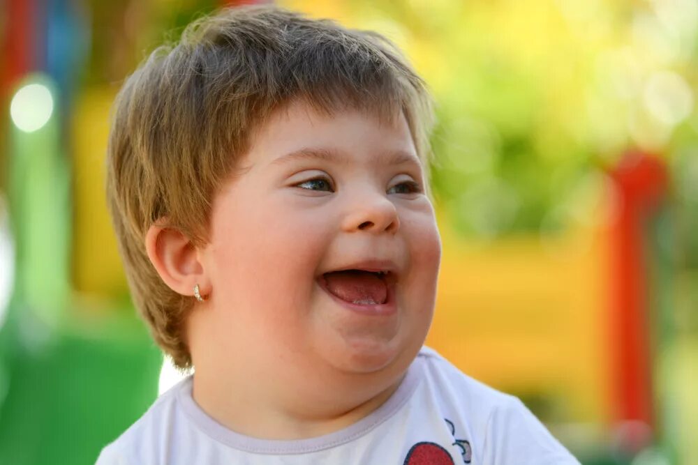 Синдром дауна. Эмоции умственно отсталых. Характеристика эмоциональной сферы. Умственно отсталые дошкольники. Эмоции умственно отсталых.