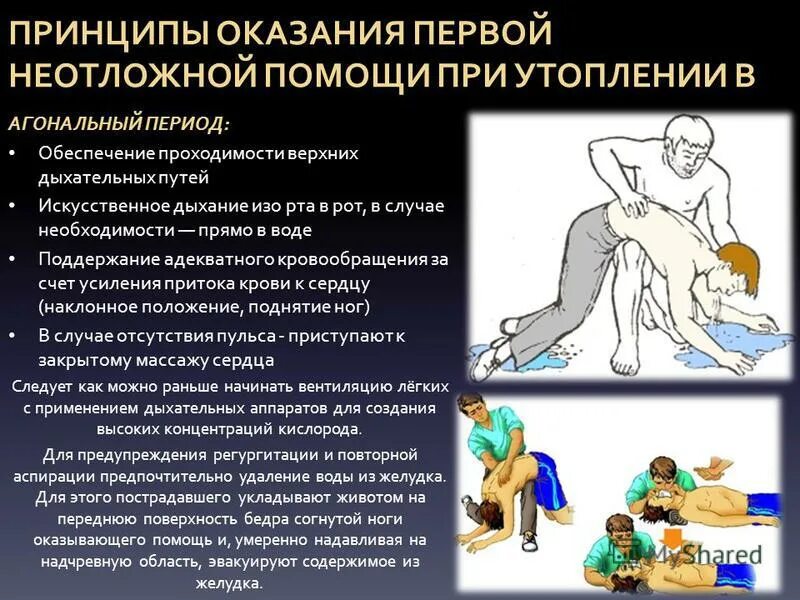 Когда можно прекращать реанимационные действия утопающему