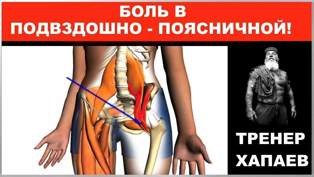 Сильная боль в подвздошной. Подвздошная мышца болит. Синдром подвздошно-поясничной мышцы. Подвздошно-поясничная мышца упражнения.