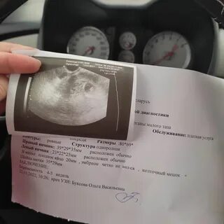 Плодное яйцо 3 мм