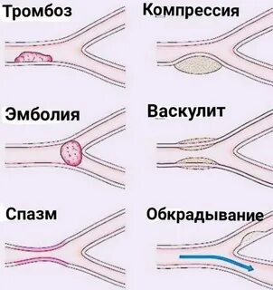 Тромб и эмбол