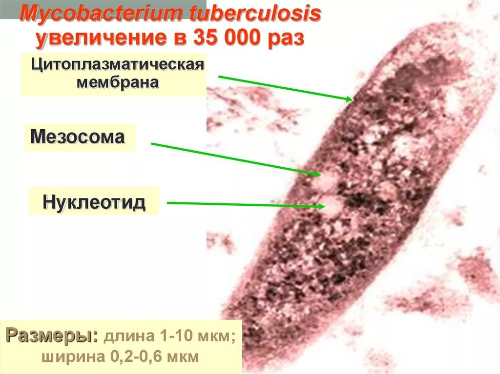 Палочки – микобактерия туберкулеза. Антигенная структура микобактерий туберкулеза. Состав микобактерии туберкулеза. Строение микобактерии туберкулеза.