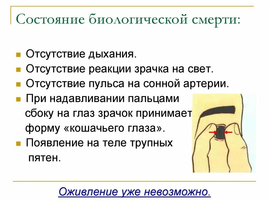 Состояние биологической смерти. Пульс при биологической смерти. Состояние дыхания при биологической смерти. Отсутствие реакции зрачка на свет признак отсутствия