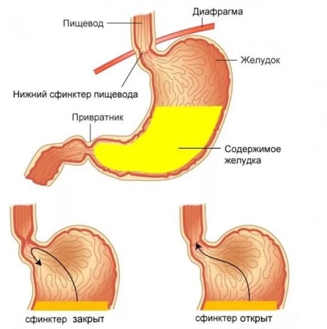 Как восстановить пищевод