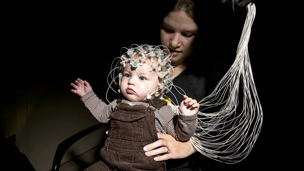 Ээг головы ребенку. ЭЭГ. Электроэнцефалография у детей. ЭЭГ головного мозга ребенку. ЭЭГ маленькому ребенку.