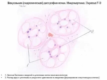 Микропрепарат канальцы почек