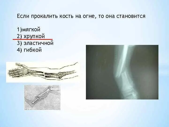 Если прокалить кость на огне то она становится. Опыт с прокаливанием кости. Прокаленная на огне кость. Кость поместили в 3 соляную кислоту