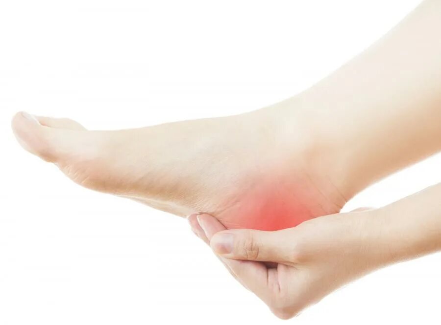 Болит сбоку пятки с внутренней стороны. Очень сильные боли в пятке. Ахиллобурсит пяточной. Очень сильные боли в пятке. Очень сильные боли в пятке.