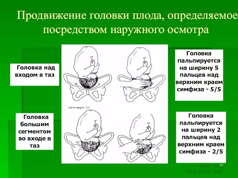 Сегменты головки. Большой и малый сегмент головки плода. головка плода малым сегментом. головка плода над входом. брльшойсегмент головки порда.