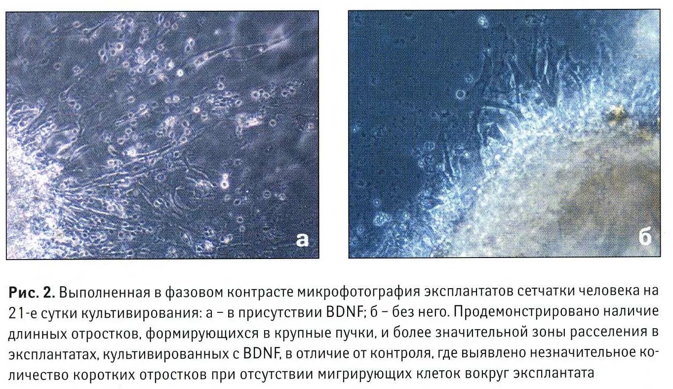 описание микрофотографий
