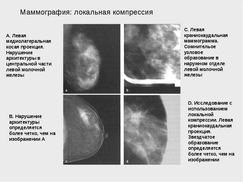 Центр маммограммы