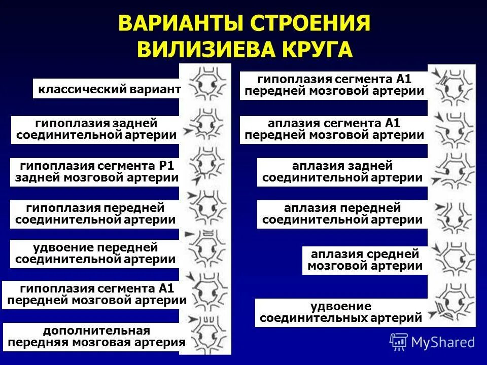 Гипоплазия правой головного мозга