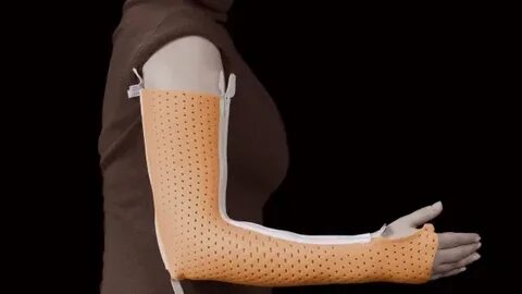 Пластиковый гипс на палец
