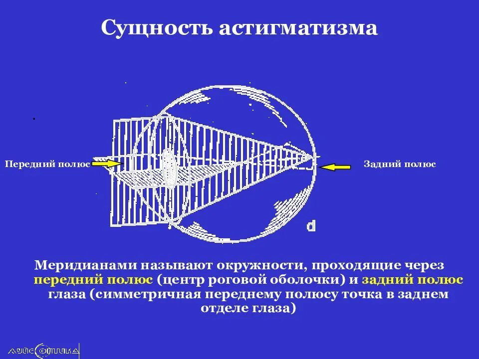 Задний полюс глаза. Астигматизм. Классификация астигматизма. Астигматизм прямого и обратного типа. Главные меридианы астигматического глаза это.