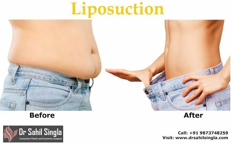 Maintain after. Before after картинки. lose belly fat приложение. before after icon.