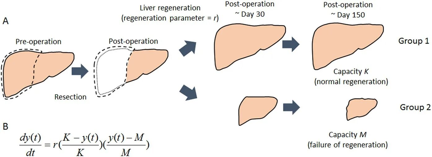 Операции posting. Регенерация печени схема. Способность печени к регенерации. Регенерация печени у человека.