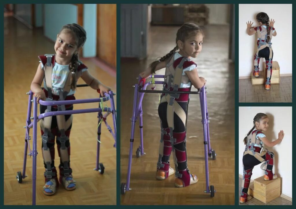 ходьба детей с дцп. трость для ходьбы детская. кенгуру ходунки для детей с дцп. ходьба детей с дцп. вертикализатор с электроприводом для детей с дцп.