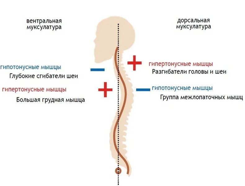 Дисбаланс как исправить