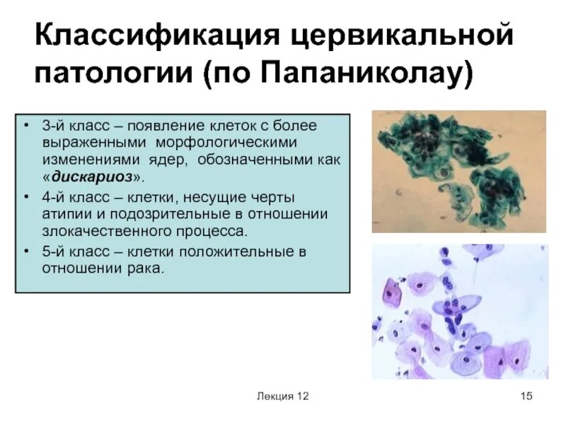 Классификация Папаниколау патологии шейки матки. Цитограмма классификация по Папаниколау. Мазки по Папаниколау классификация. Классификация по Папани.