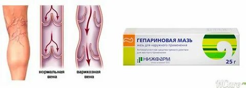 Мазь для вен