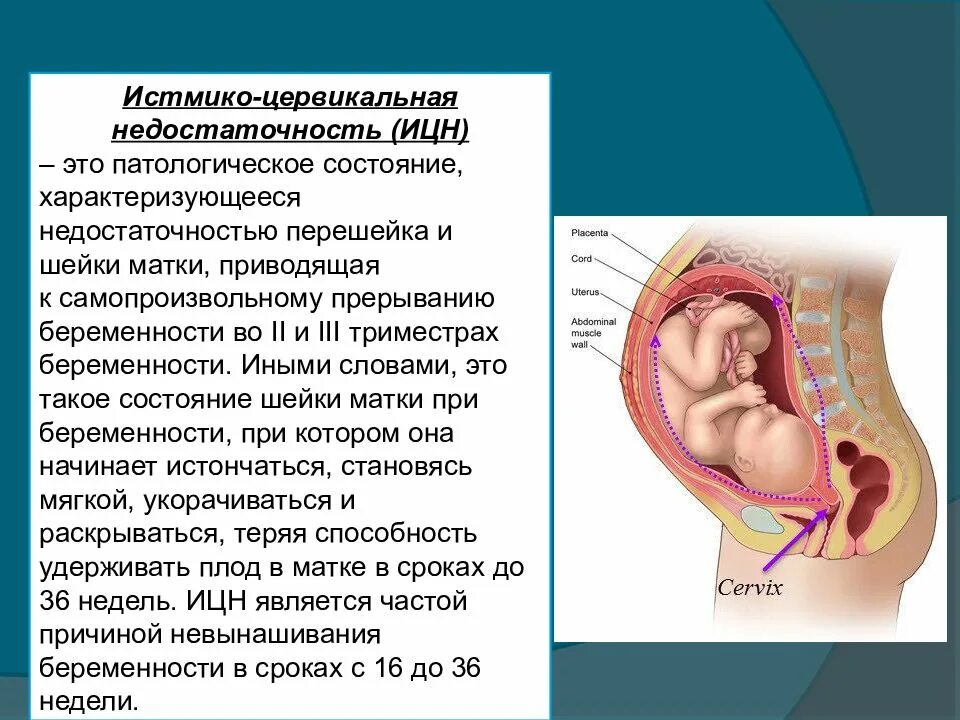 Шейка матки при беременности второй триместр