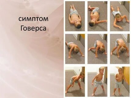 Генетическая мышечная дистрофия