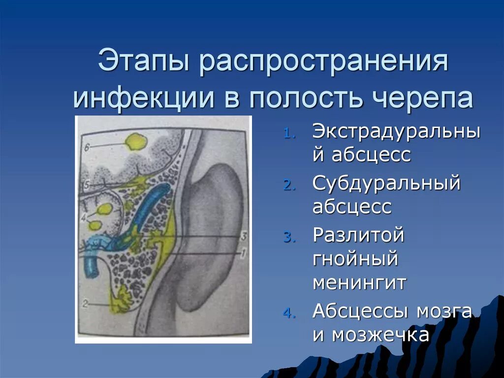 Этапы распространения. Этапы распространения инфекции. Стадии распространения инфекции. Этапы распространения. Этапы распространения.
