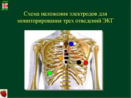 Датчики холтера схема