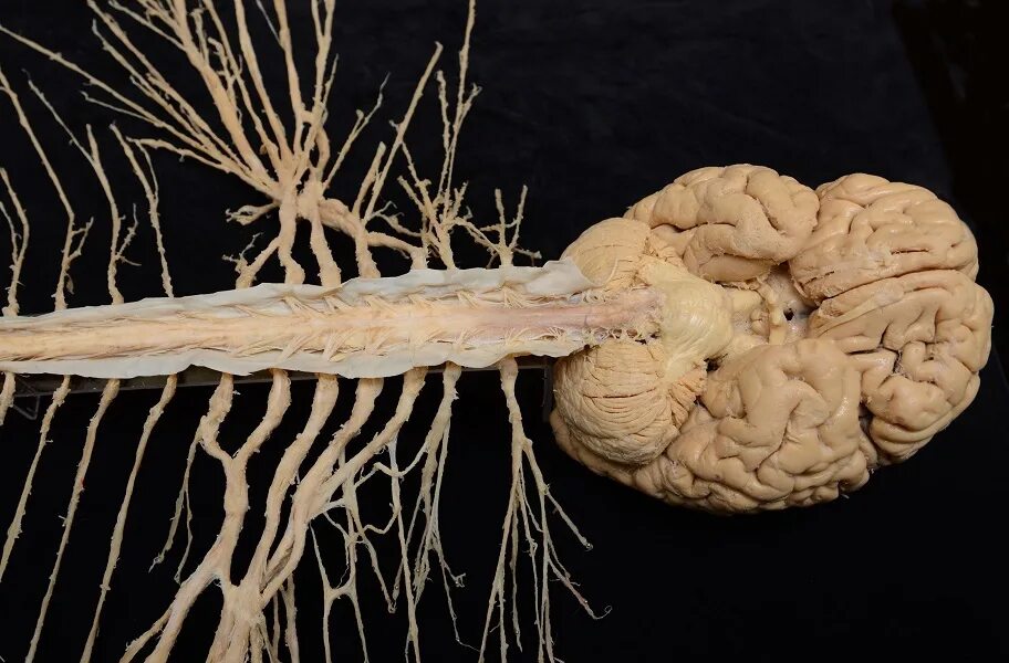 Центральная нервная система головной и спинной мозг. Спинной мозг препарат анатомия. Головной мозг спинной мозг нервы. Нервная система спиннрй МОЗГАНАТОМИЯ.