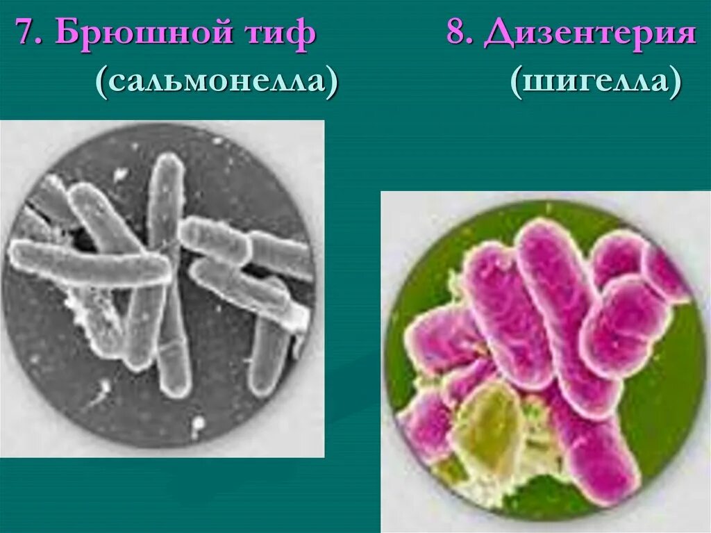 Возбудители дизентерии брюшного тифа. Шигеллы дизентерии. Шигеллы сальмонеллы. Шигелла колонии. Шигеллез сальмонеллез