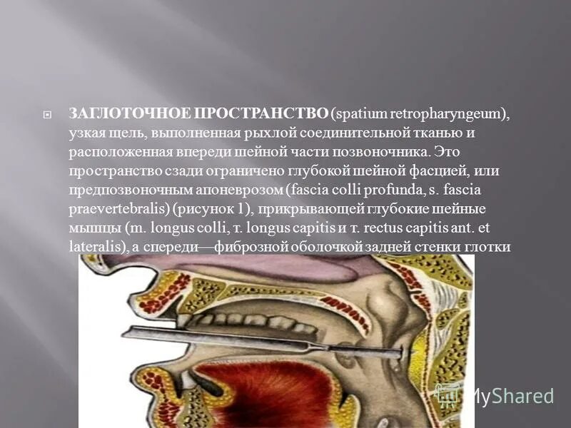 Пространства глотки. Позадиглоточное пространство топографическая анатомия. Паратонзиллярное пространство. Клетчаточное пространство глотки. Пространства глотки.