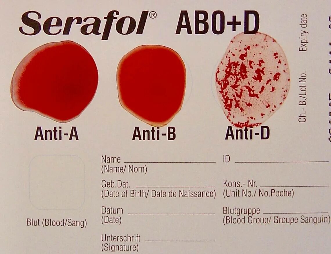 Ab0 группа крови. Цвет крови. Группа крови цвет крови.