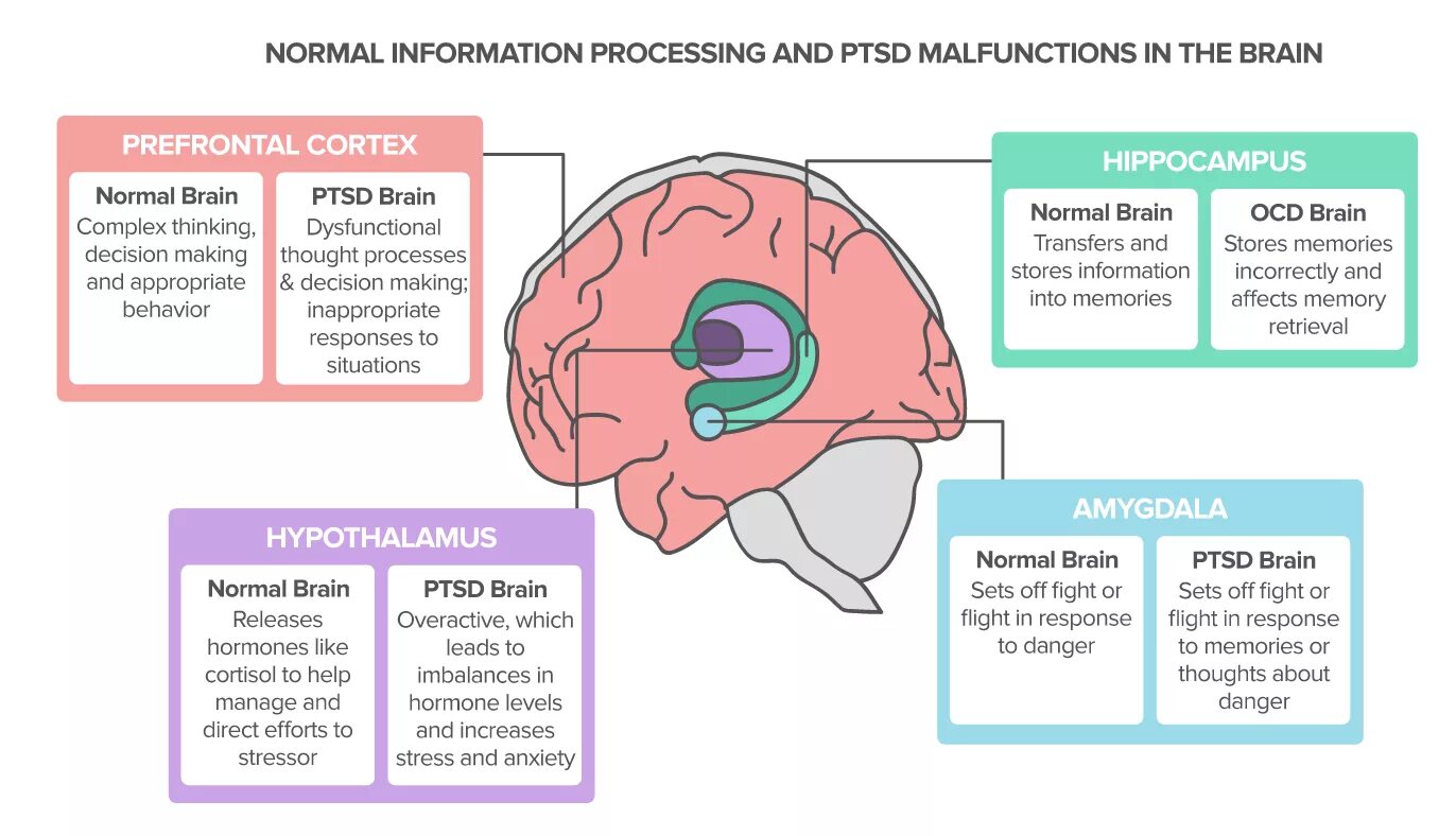 Brain processing. ПТСР мозг. Нейробиология ПТСР. PTSD Brain. Мозг в стрессовой ситуации.