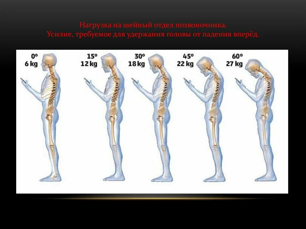 Нагрузка на шейный отдел позвоночника. Нагрузка на позвоночник. Нагрузка на позвоночник при наклоне. Нагрузка на позвоночник при наклоне головы.