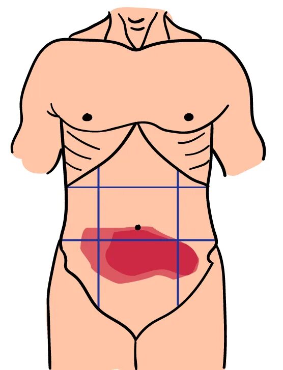 Левая боковая область живота. Нижняя часть живота. Верхняя половина живота. Боли в животе. Точки боли в животе.