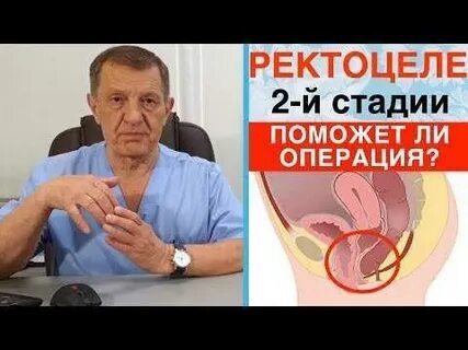 Цистоцеле 2 степени