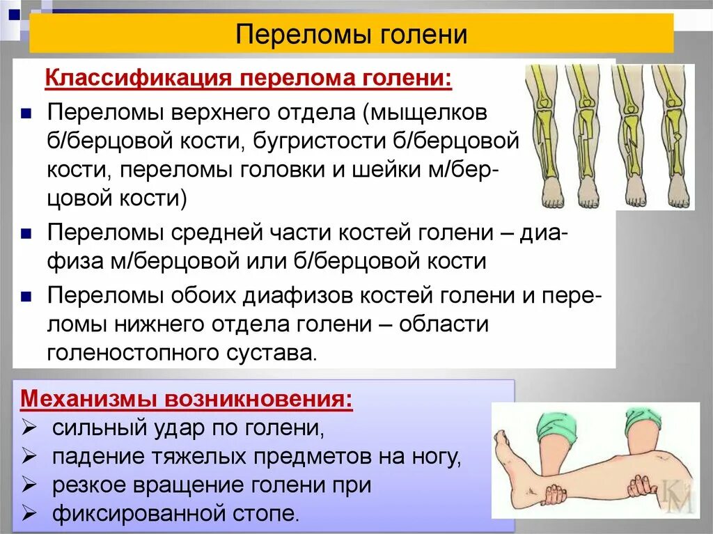 Виды переломов и первая помощь при них. Классификация переломов диафиза голени. Классификация переломов костей голени. Перелом кости классификация. Переломы костей конечностей.