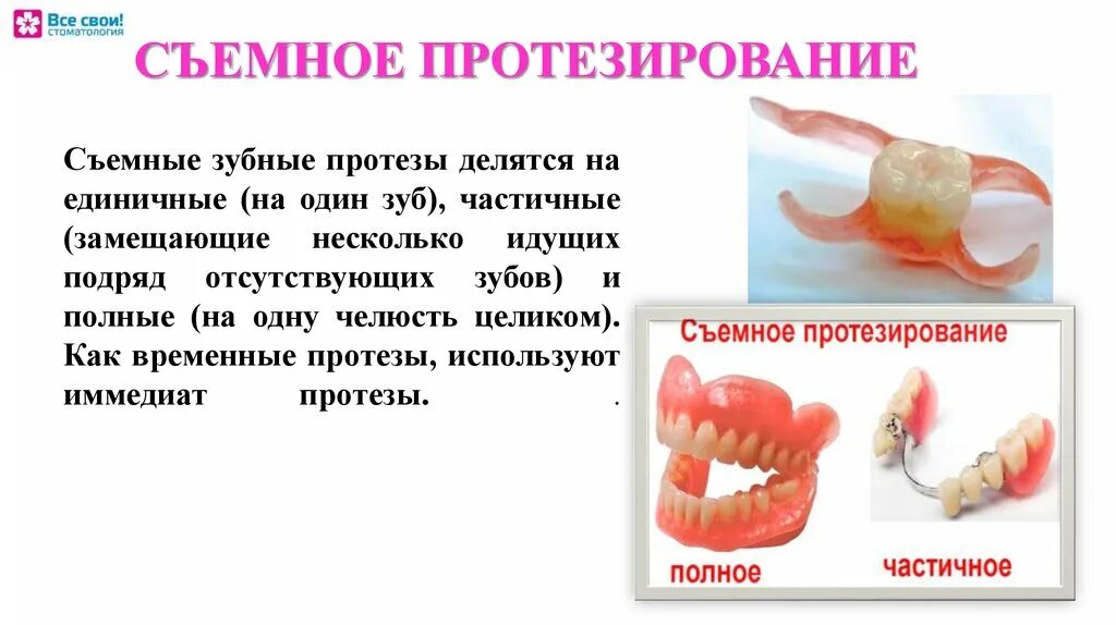 Съемный пластиночный протез показания. Классификация иммедиат протезов. Что такое иммедиат протез в стоматологии. Непосредственное протезирование иммедиат протезы.