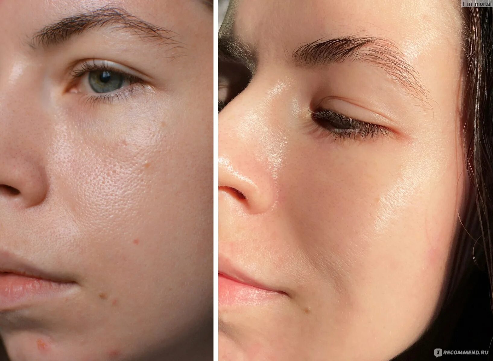 Антивозрастной крем для лица SeSDERMA Reti Age Anti-aging Cream - "