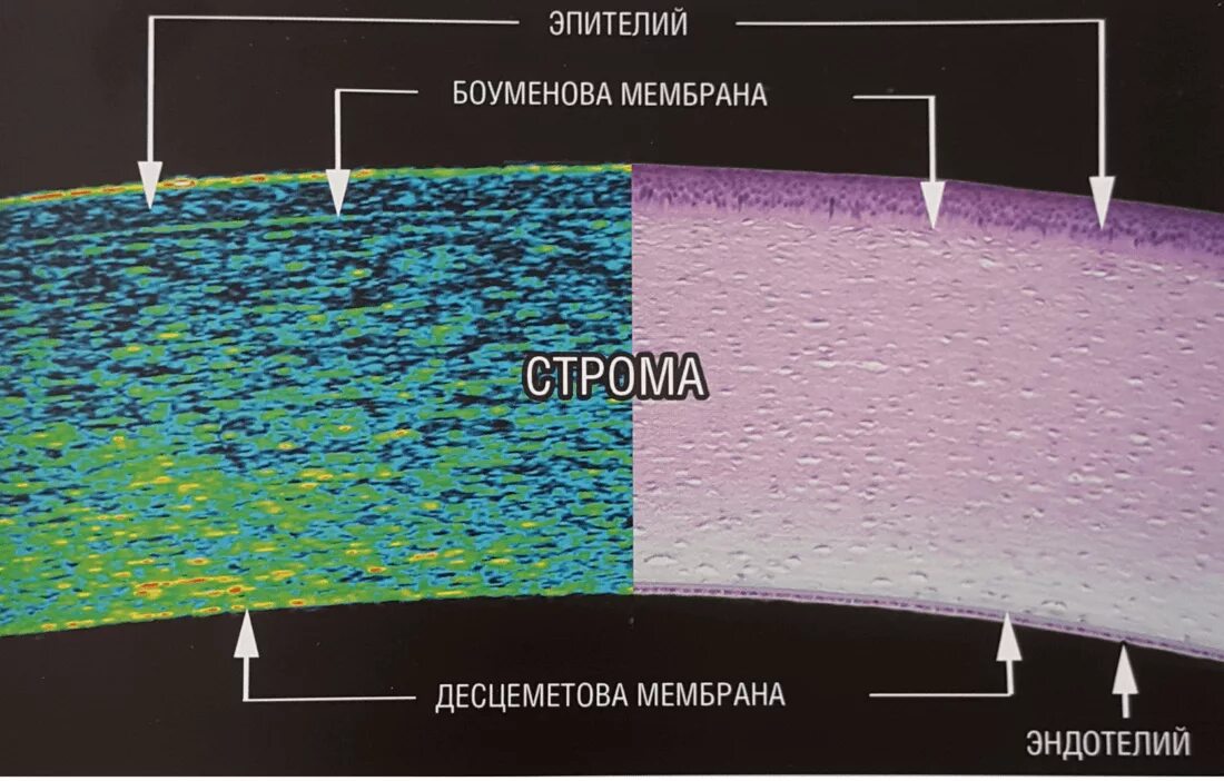 Строение роговицы гистология. Слои роговицы глаза анатомия. Слои роговицы глаза гистология. Роговица характеристика